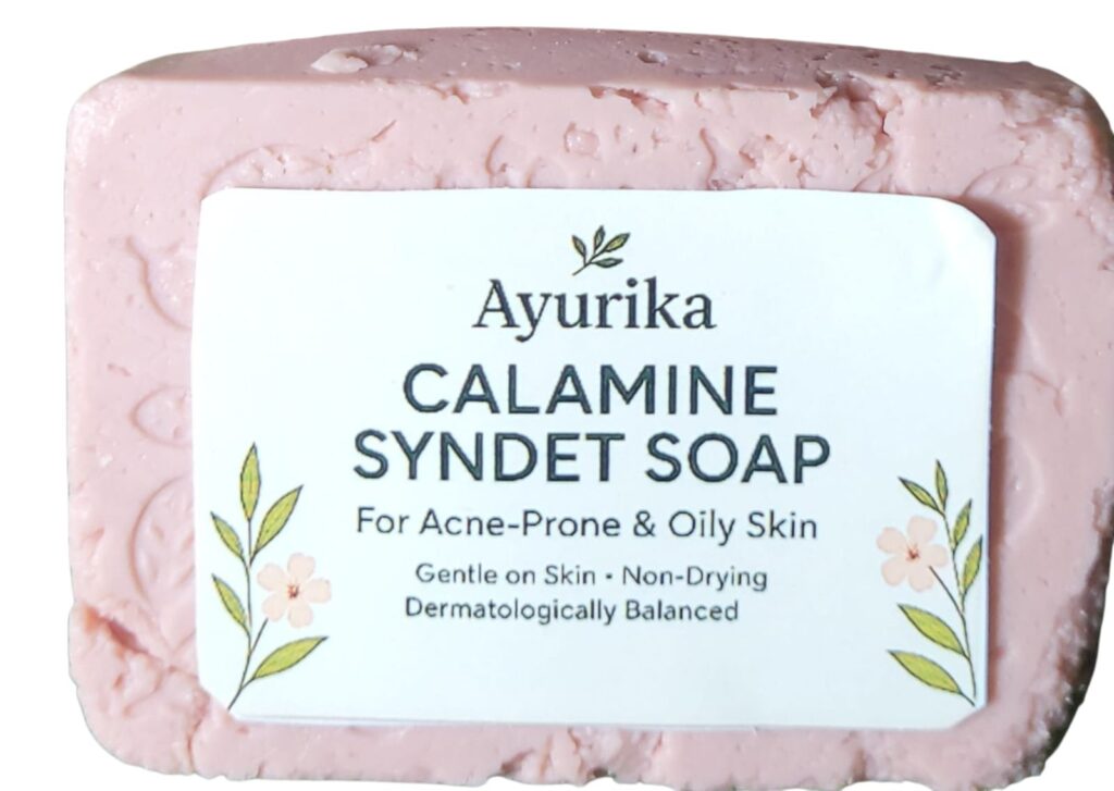 Hormonal Pigmentation reduction Diet plan 3 Ayurika Calamine Syndet Soap